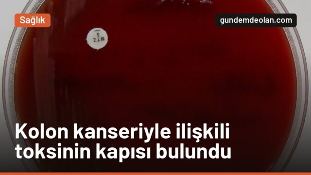 Bağırsak bakterisi kolon kanserini nasıl tetikliyor? Yeni çalışma