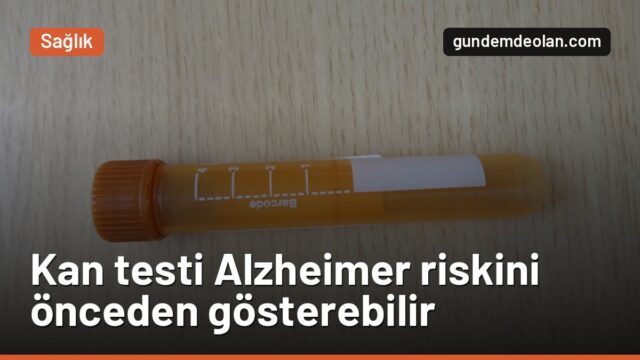 Alzheimer riski kan testiyle yıllar önce görülebilir mi? Yeni çalışma